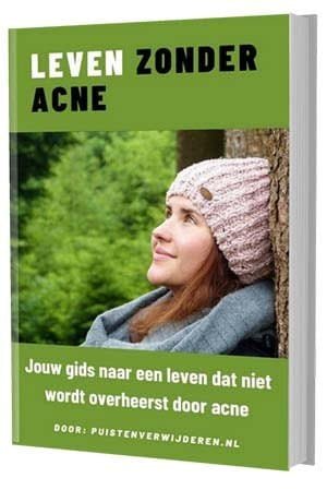 leven zonder acne ebook 1